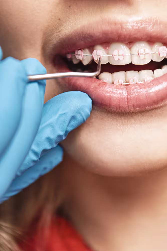 03_25 Do Braces Hurt_ What to Expect During Orthodontic Treatment 3 03 25 Do Braces Hurt What To Expect During Orthodontic Treatment 3